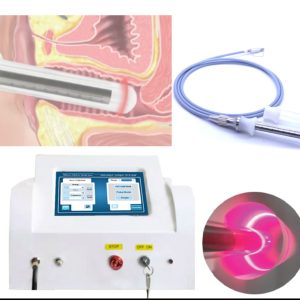 Vaginal Titghtening Rejuvenation