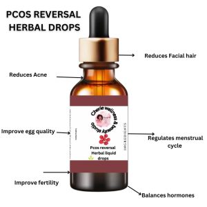 PCOS Reversal Herbal Drops